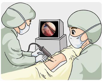 人體植入醫(yī)療器械封口潔凈要求